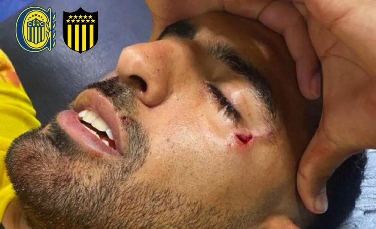 Защитник «Пеньяроля» получил камнем по голове во время матча